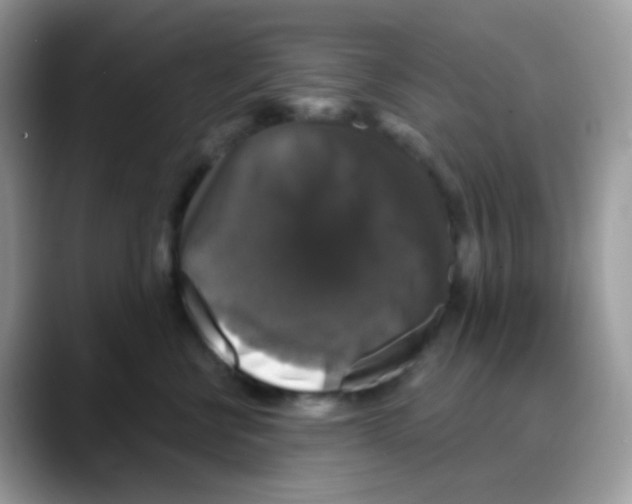 X0000088140570200706111427