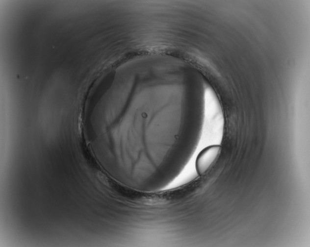 X0000088140644200706111426