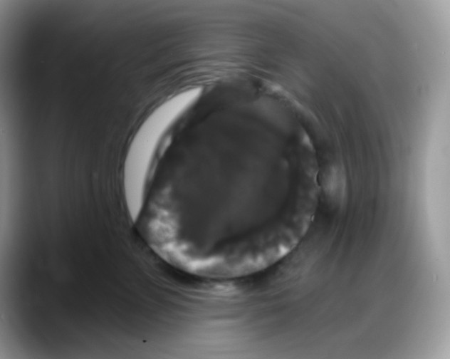 X0000088140715200706111425