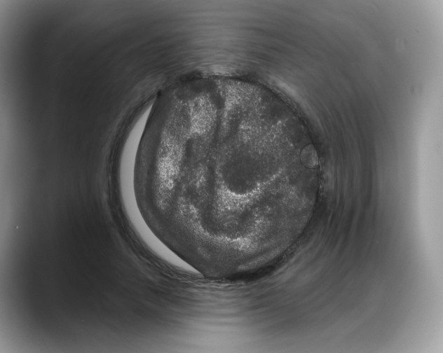 X0000088140738200706111425