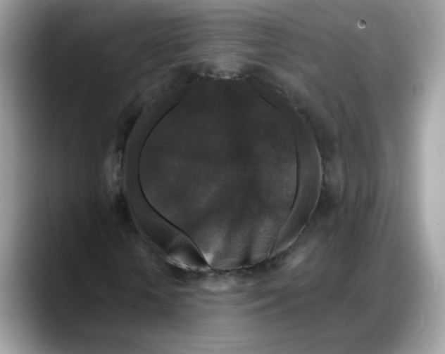 X0000088140818200706111424