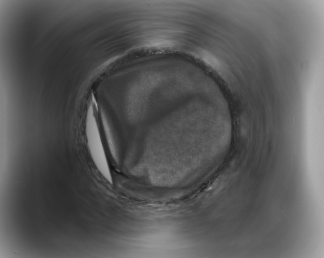 X0000088140872200706111423