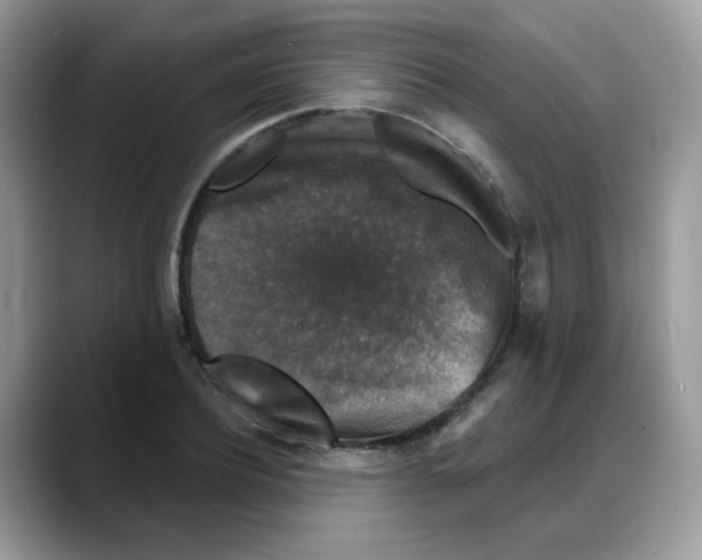 X0000088140932200706111423