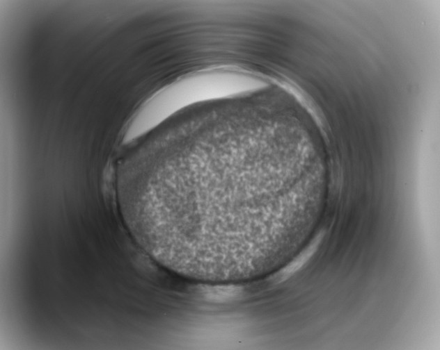 X0000088141001200706111422