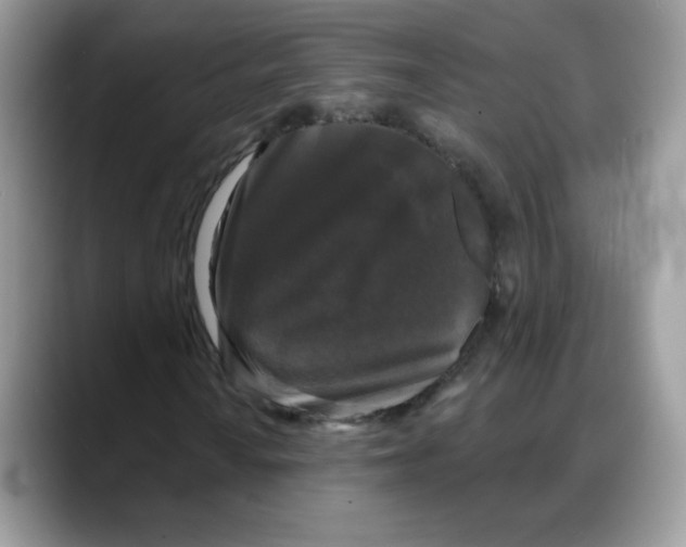 X0000088141010200706111421