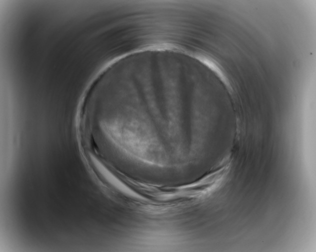 X0000088141046200706111422