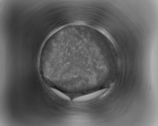 X0000088141052200706111422