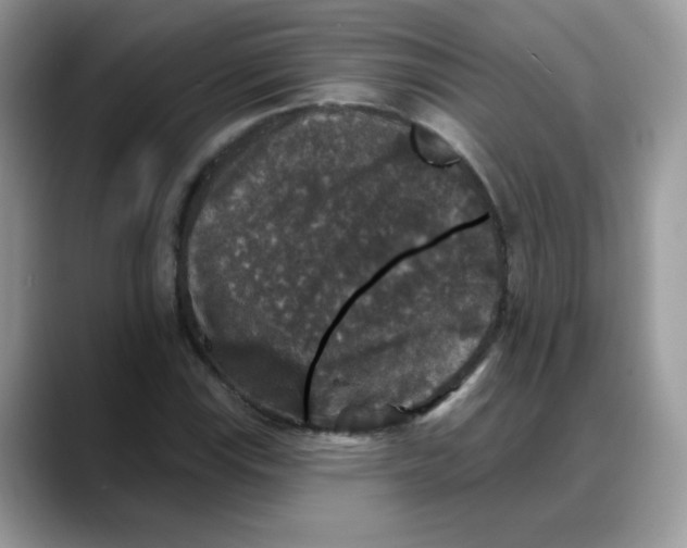 X0000088141115200706111420