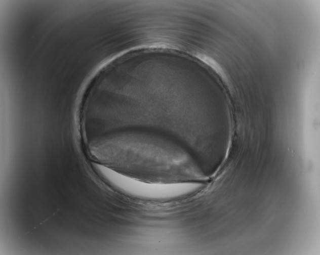 X0000088141120200706111420