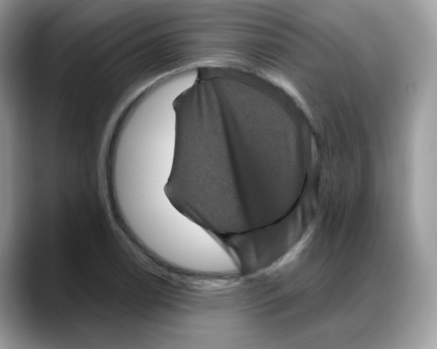 X0000088141122200706111420