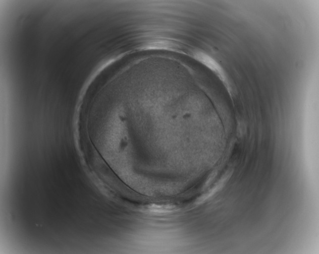 X0000088141138200706111420