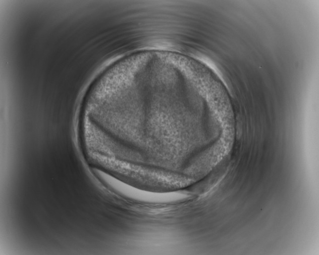 X0000088141139200706111420