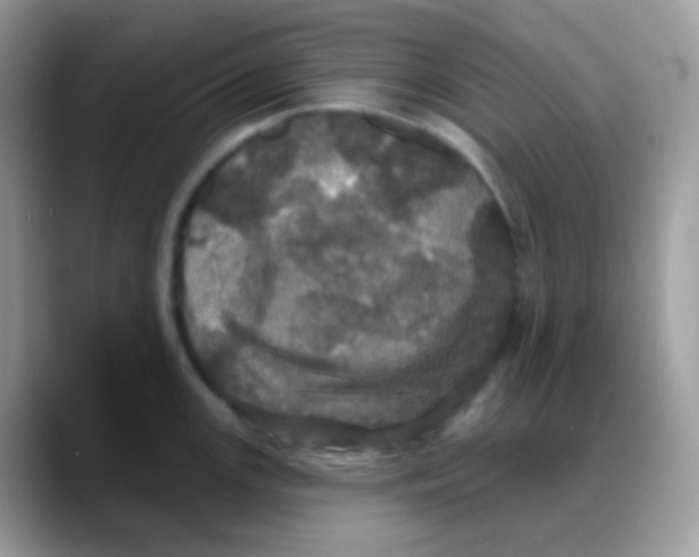 X0000088141147200706111421