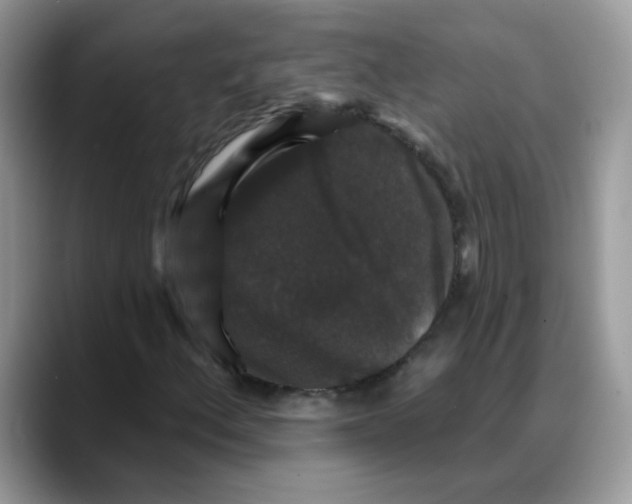 X0000088141156200706111420