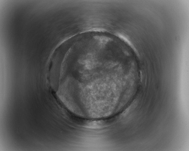 X0000088141165200706111420