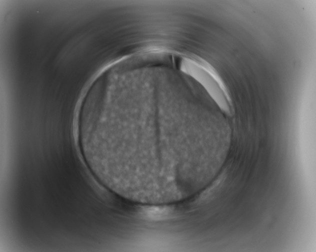 X0000088141195200706111419