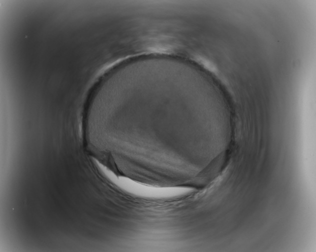 X0000088141214200706111419