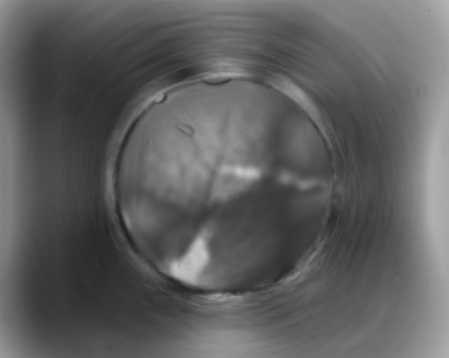 X0000088141243200706111419