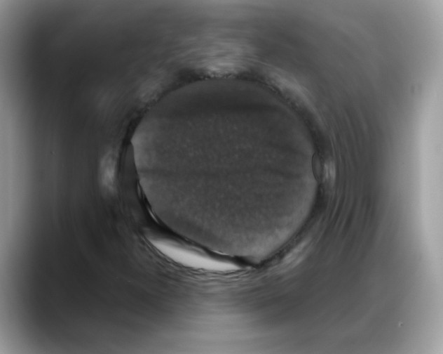 X0000088141300200706111418