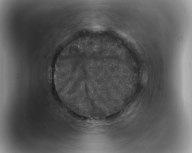 X0000088141301200706111418