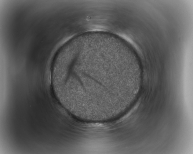 X0000088141317200706111418