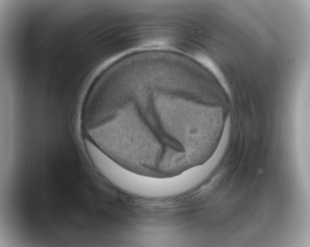 X0000088141336200706111418