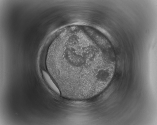 X0000088141375200706111417