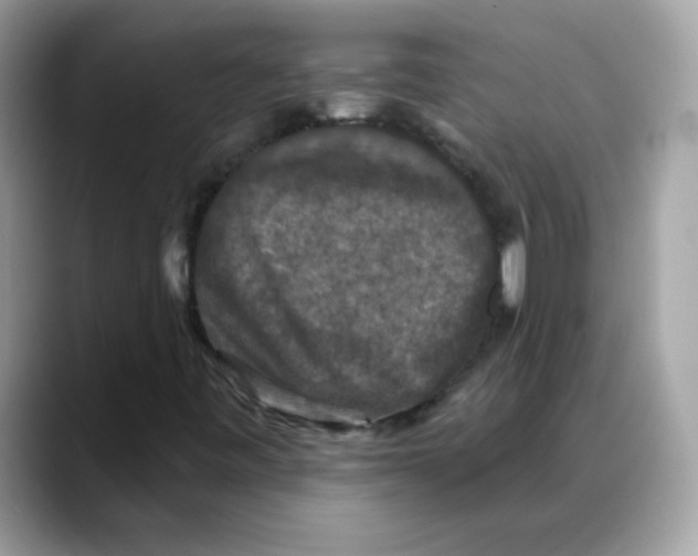 X0000088141443200706111417