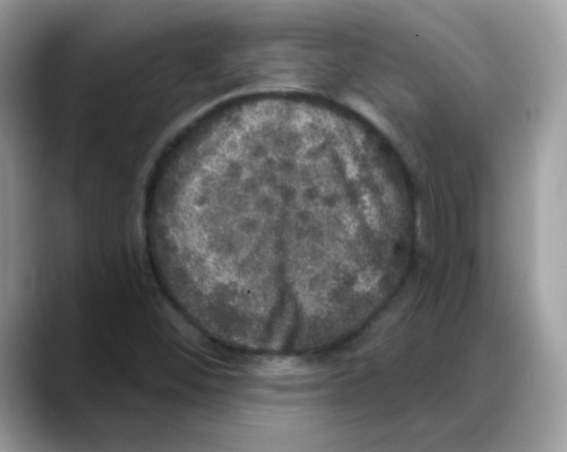 X0000088141452200706111417