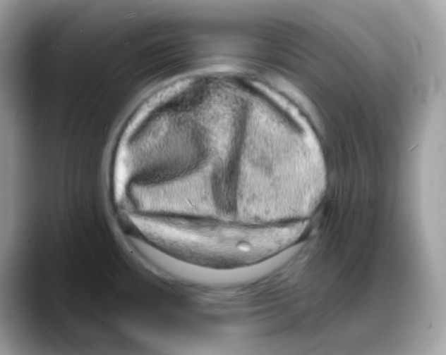 X0000088141483200706111416