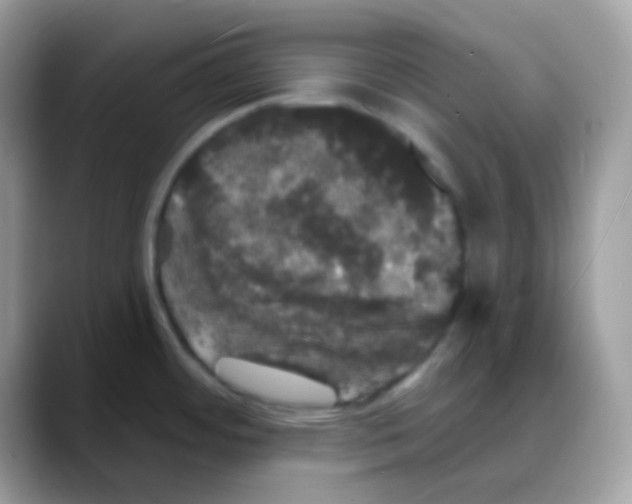 X0000088141484200706111416