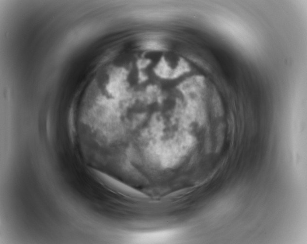 X0000088141487200706111416