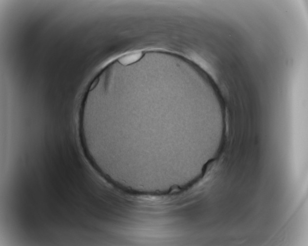 X0000088141500200706111416