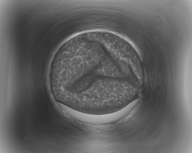 X0000088141534200706111416