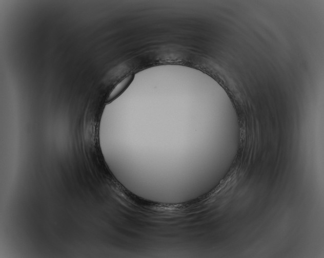 X0000088150093200705141100