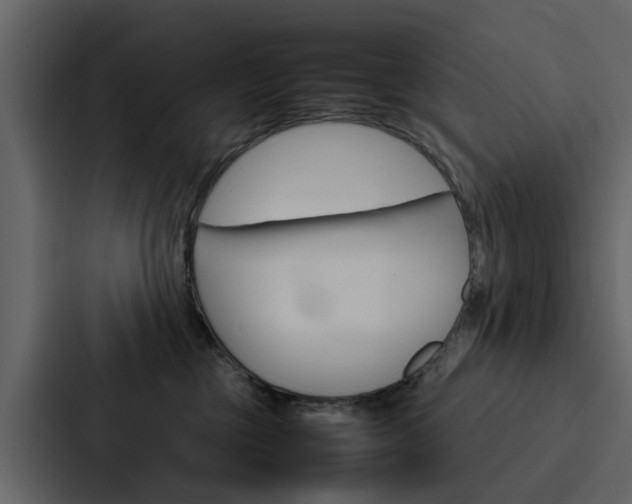 X0000088150377200705141056