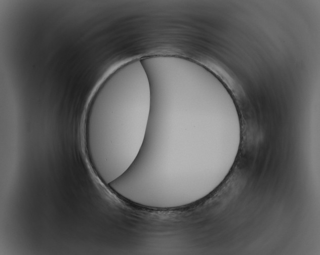 X0000088151000200705141048