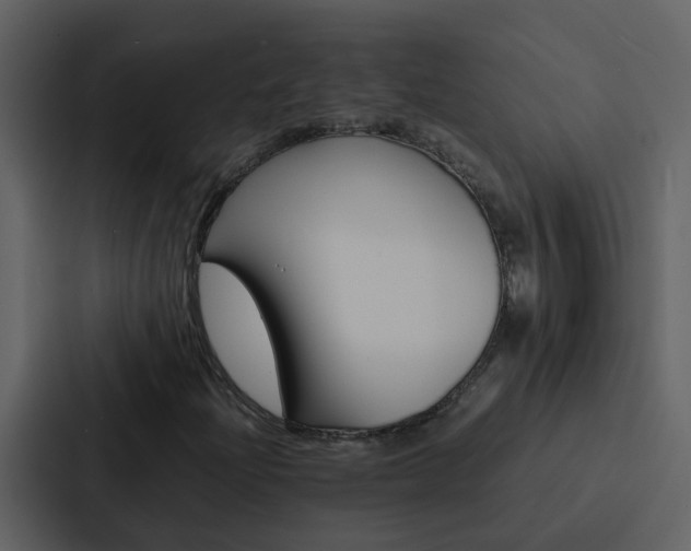 X0000088151204200705141045