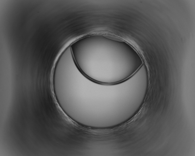 X0000088151392200705141043