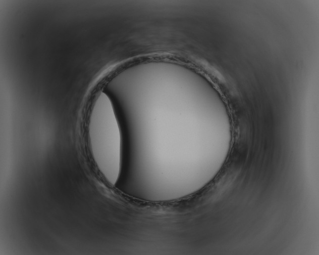 X0000088151400200705141042