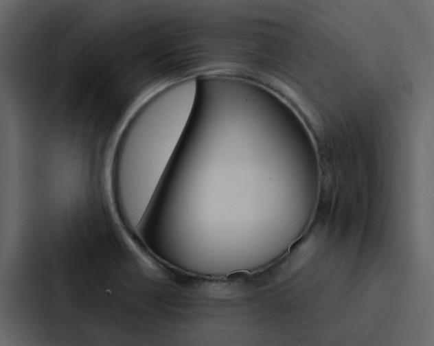 X0000088151418200705141042