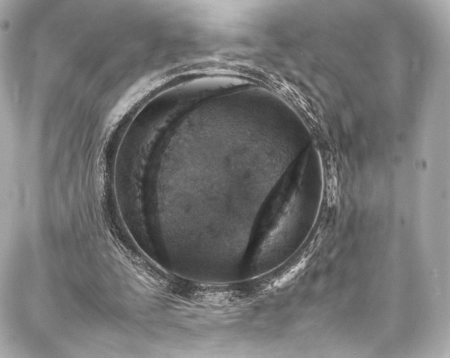 X0000088150295200705141555