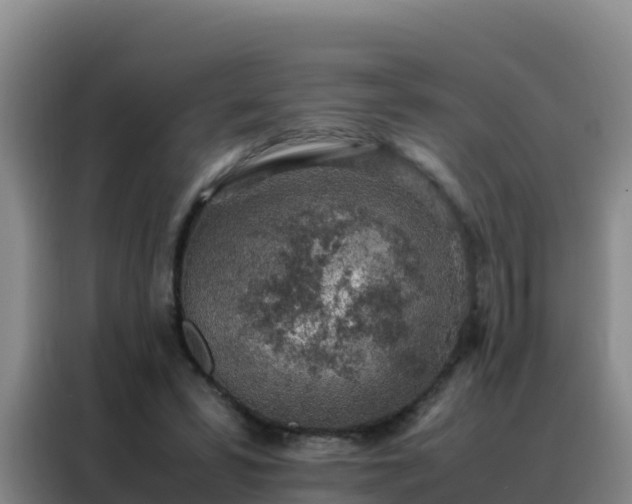 X0000088150399200705211200