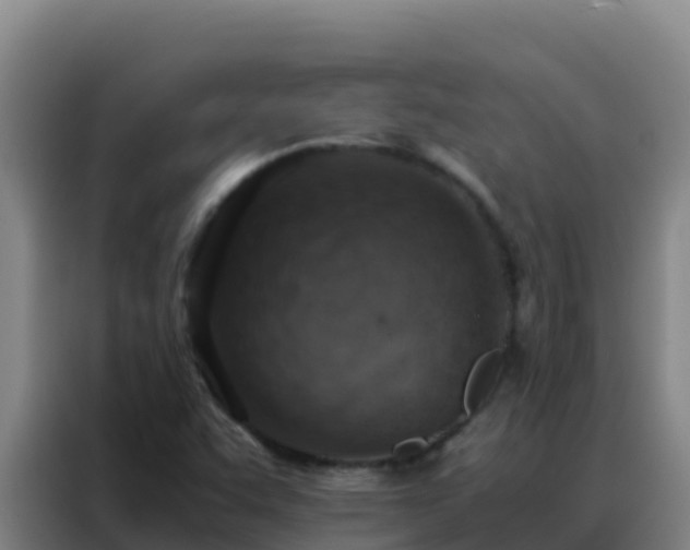 X0000088151455200705211146