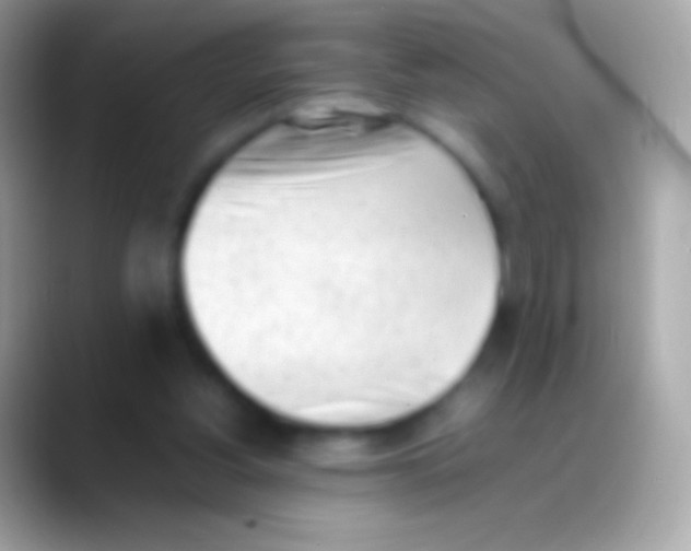 X0000088150156200706041401