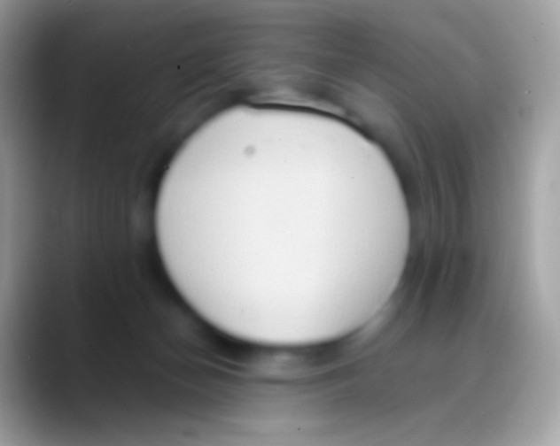 X0000088150174200706041401