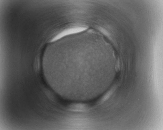 X0000088150205200706041401