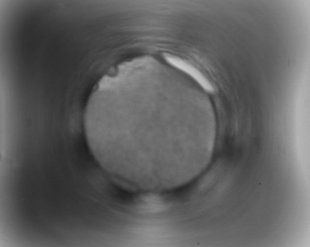 X0000088150325200706041359