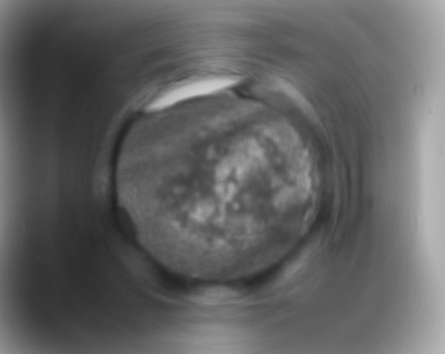 X0000088150399200706041358