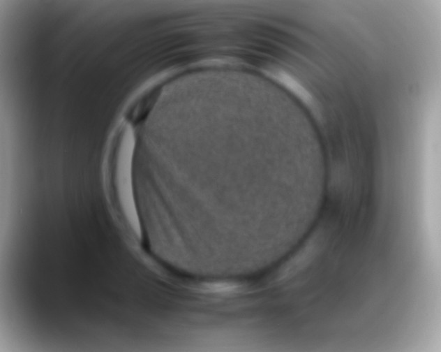 X0000088151037200706041351